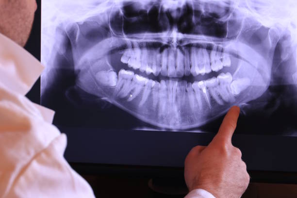 Best After-Hours Emergency Dentist in Lithopolis, OH