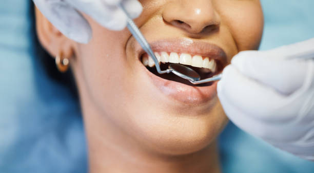 Best Emergency Tooth Extraction in Lithopolis, OH