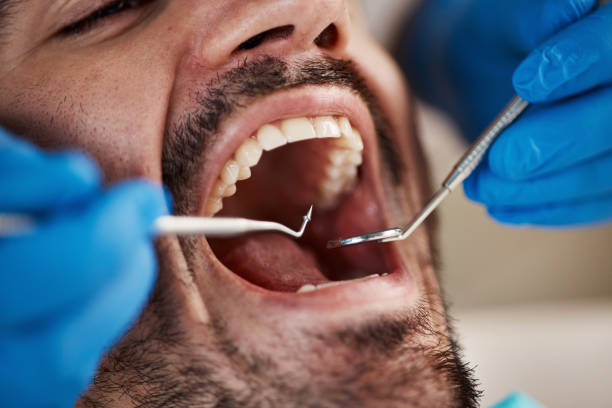 Best Walk-In Emergency Dentist in Lithopolis, OH