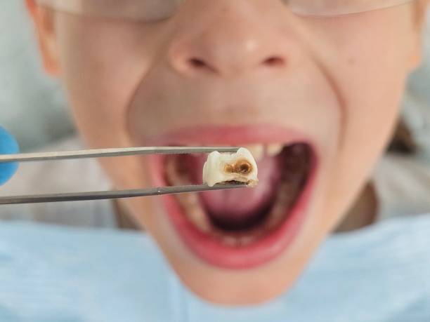 Best After-Hours Emergency Dentist in Lithopolis, OH